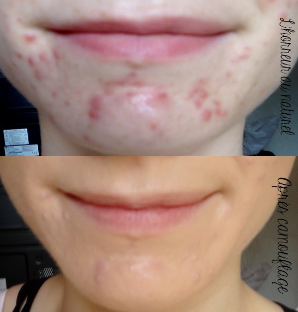 Pomme De Terre Visage Avant Apres