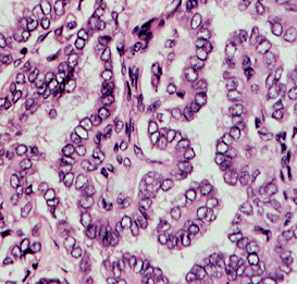 papilloma virus e un herpes