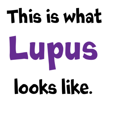 Lupus (Systemic Lupus Erythematosus or SLE) Symptoms ...