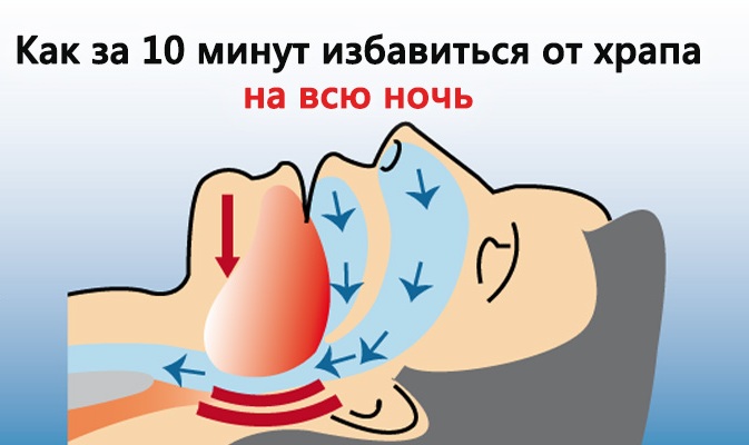 Тейпирование от храпа схема