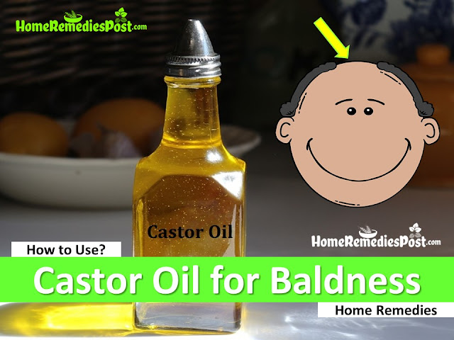 Castor Oil for Baldness, Home Remedies for Baldness, How To Get Rid Of Hair Loss, How To Get Rid Of Baldness, how to stop hair loss,