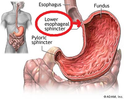 Disfungsi LES Lower Esophageal Sphincter