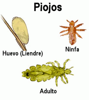 imagen piojos ninfas