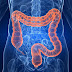 Must Read: All You Need To Know About Colorectal Cancer