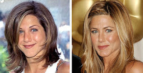 Celebrity Plastic Surgery Before and After: Jennifer Aniston Plastic ...