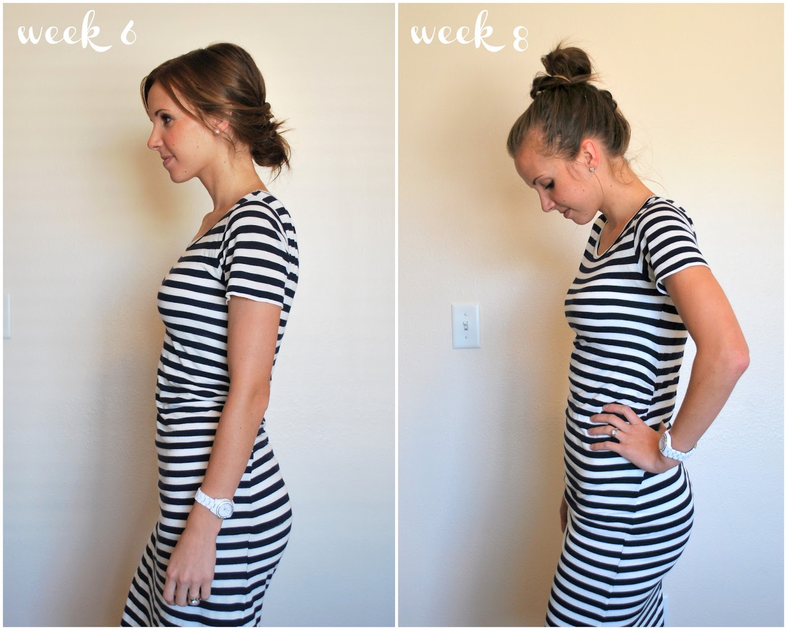 stenosis-red-spotting-and-cramping-at-5-weeks-pregnant
