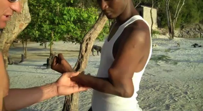 dos años con el brazo roto