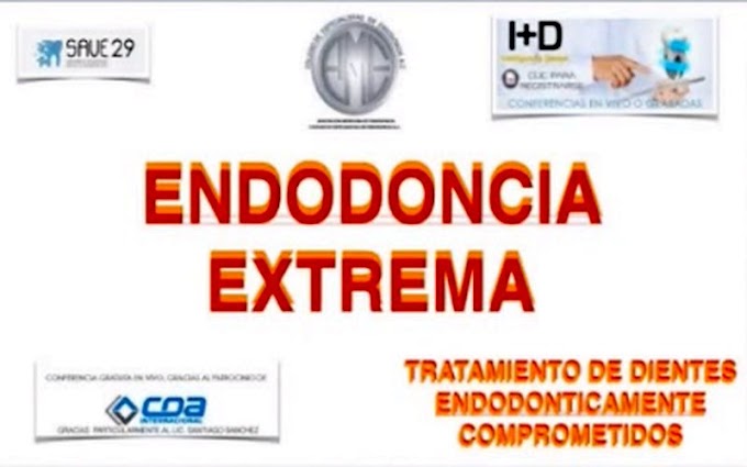 WEBINAR: ENDODONCIA Extrema - Dr. Alberto Díaz Tueme