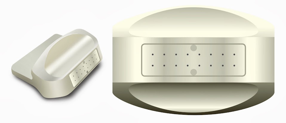 What is Mycrolator? What is Mycrolator?
