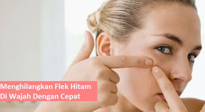Menghilangkan flek hitam di wajah dengan cepat Menghilangkan flek hitam di wajah dengan cepat