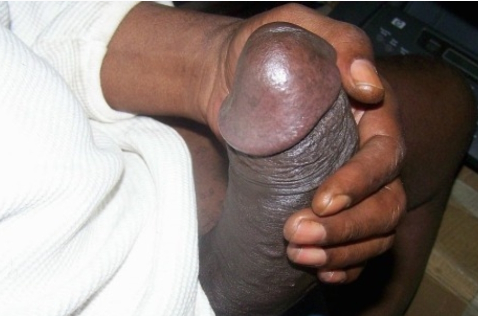 Black big dick uncut otngagged