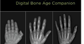 Bone Age Wrist Chart