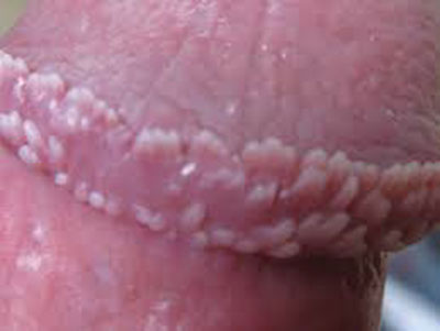 Phân biệt giữa sùi mào gà và các bệnh khác | Yêu Thú Cưng - Vietnam's Pet Forum