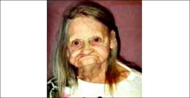 Top Populer Orang Terjelek Di Dunia, Istimewa!