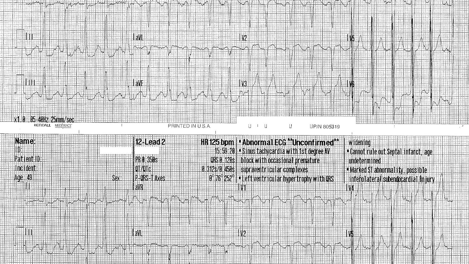 Does Ekg Show Heart Problems Hear Choices