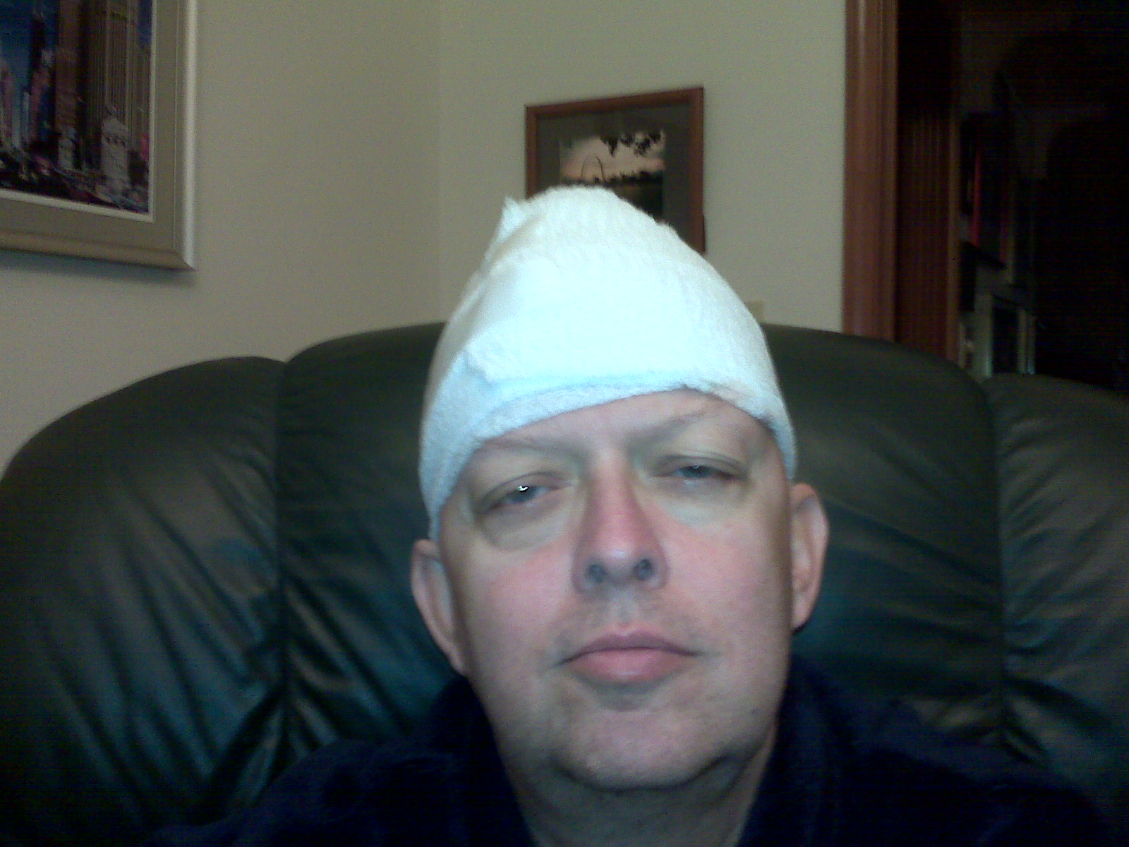 Jim Allen Lung Cancer Happens and we live on. 8/30 Gamma Knife