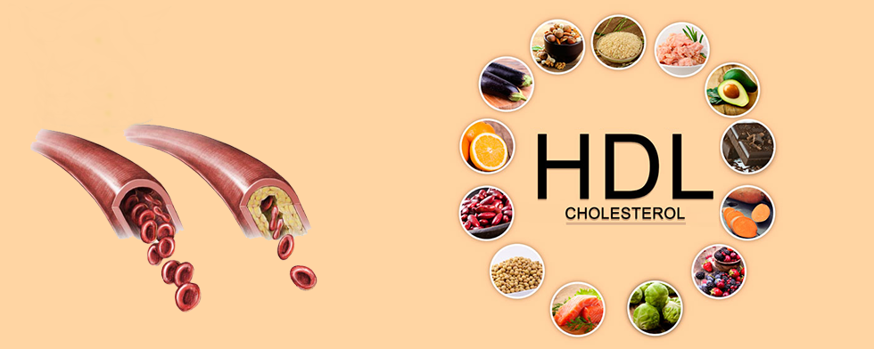 11 Alimentos para aumentar seu HDL