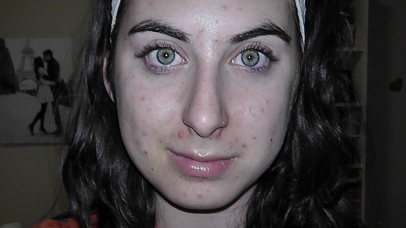 Random Thoughts of a Shopaholic My bad skin and how I cleared it!