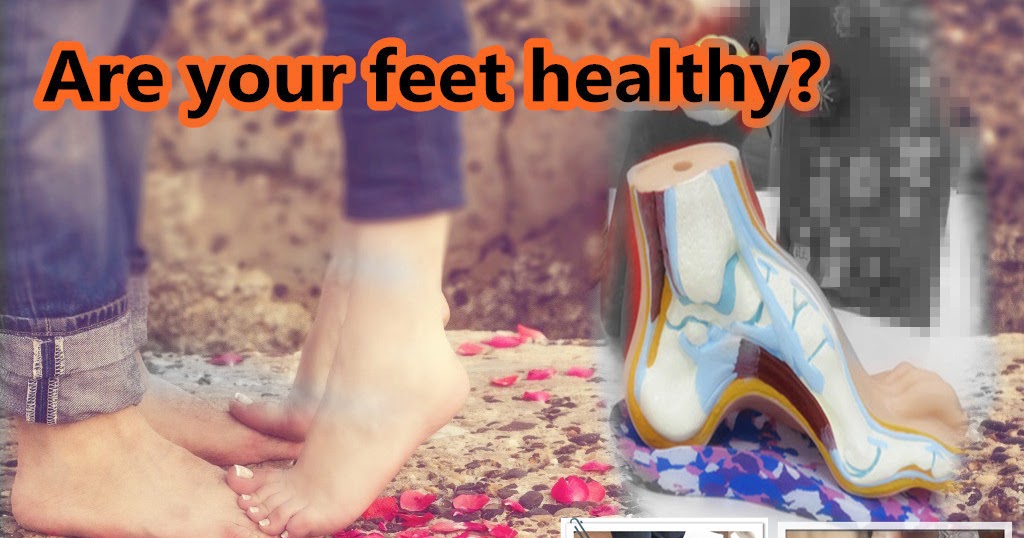 Get Your FREE Feet Analysis Sunfeet International Rehab Centre