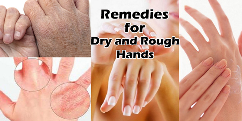 Best Home Remedies for Dry and Rough Hands In Winter Season.
