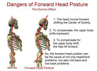 PAIN IN THE NECK! - Functional Holistic Nutrition