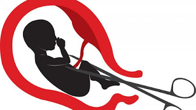 Legalkan Aborsi Di India Namun Kebanyak Tidak Layak Untuk Keamanan
