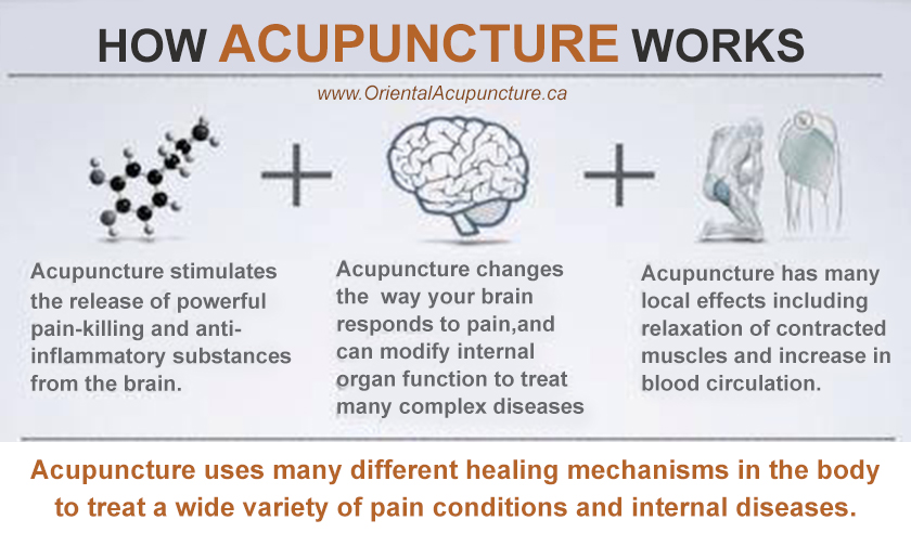 Acupuncture Massage Clinic Scarborough Celebrities Love Acupuncture