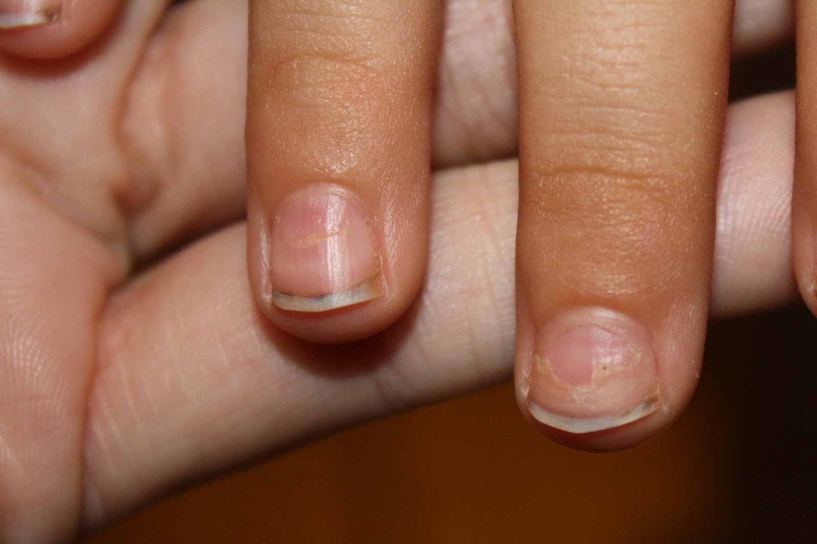 Clear Fingernails - Is It A Bad Thing? The Answer Will ...
