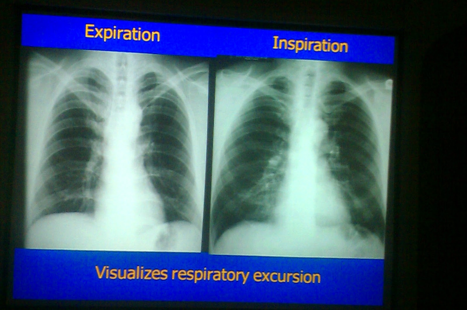 Lecture slides Radiology Chest X ray