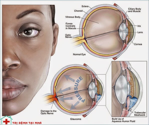 5 loại bệnh thường gặp về mắt