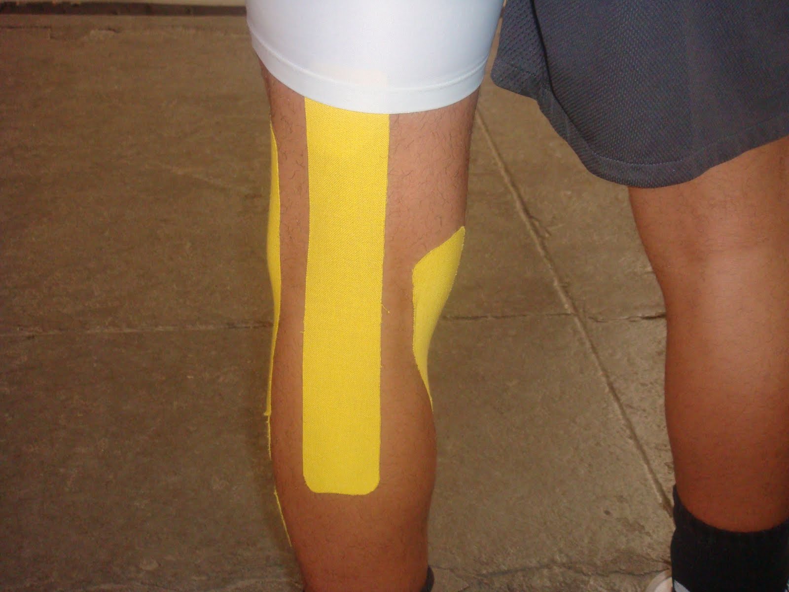 FISIOTERAPIA DESPORTIVA Conheça a bandagem terapêutica, método japonês