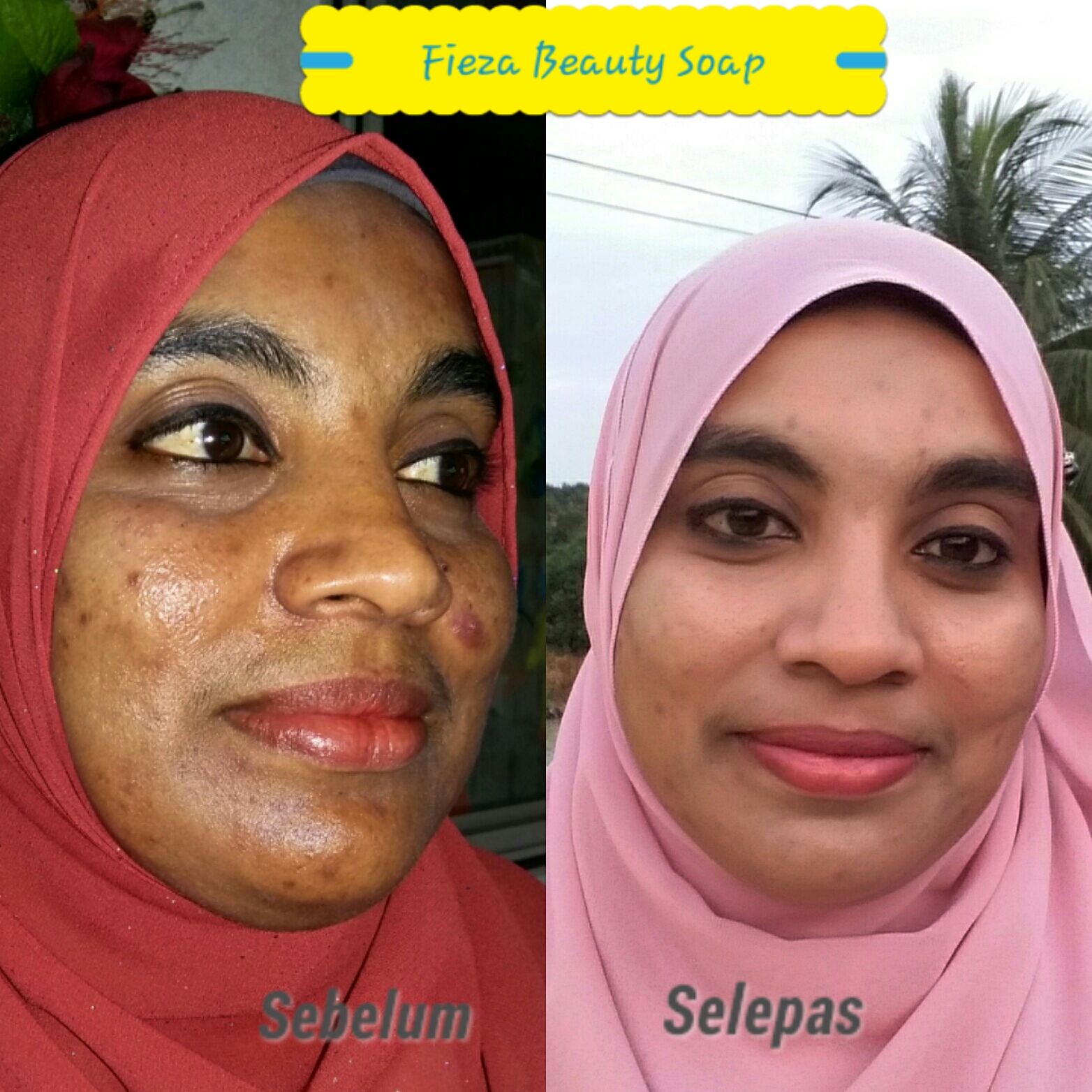 Fieza Beauty Soap JERAWAT TAK TUMBUH LAGI