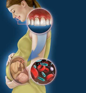 dental pregnancy overall health periodontal