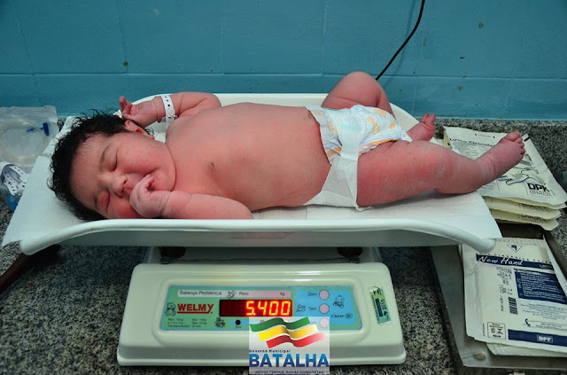 Em Batalha/AL, bebê nasce com quase 6kg e surpreende a todos em hospital
