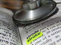 5 Important Stroke Facts to Know 5 Important Stroke Facts to Know