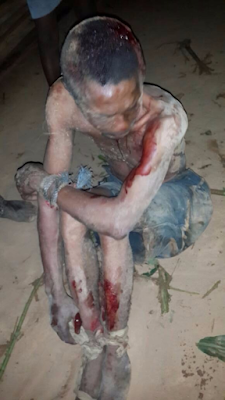 2 Man attacked by youths in Abia after they claimed he was a wizard (photos)