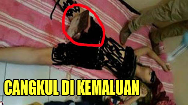 Sungguh Biadap Pelakunya! Gagang Cangkul di Kelamin Eno Tembus Hingga Paru - Paru Sungguh Biadap Pelakunya! Gagang Cangkul di Kelamin Eno Tembus Hingga Paru - Paru