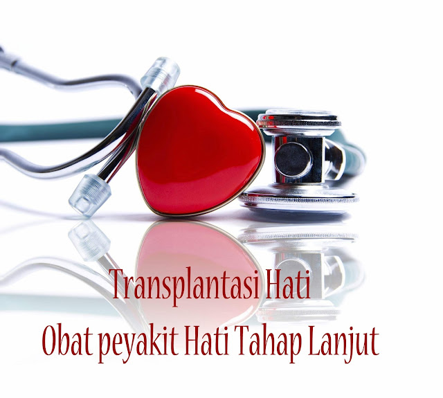 transplantasi hati obat penyakit hati