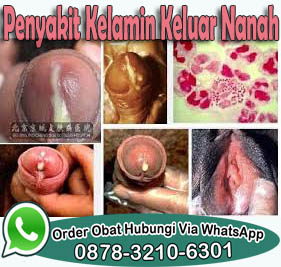 Obat Sering Kencing Dan Sakit Pinggang Obat Sering Kencing Dan Sakit Pinggang
