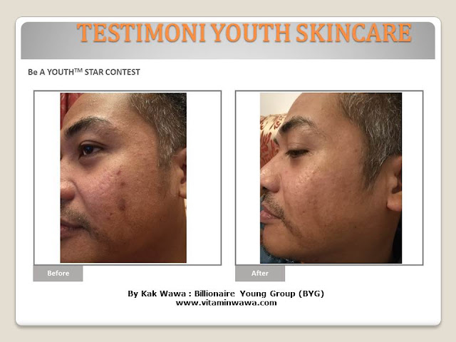 34 Testimoni Youth Skincare Shaklee Terbaru, Youth skincare shaklee, testimoni youth skincare shaklee, Youth Skincare Shaklee : Harga dan Review Pengguna Youth Shaklee, testimoni youth skincare shaklee, testimoni youth skincare shaklee 34 Testimoni Youth Skincare Shaklee Terbaru, Youth skincare shaklee, testimoni youth skincare shaklee, Youth Skincare Shaklee : Harga dan Review Pengguna Youth Shaklee, testimoni youth skincare shaklee, testimoni youth skincare shaklee