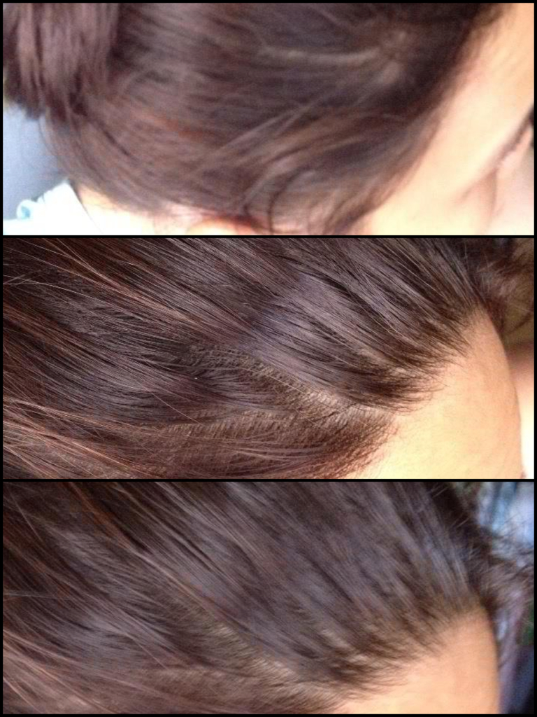 side effect of black tea on hair
