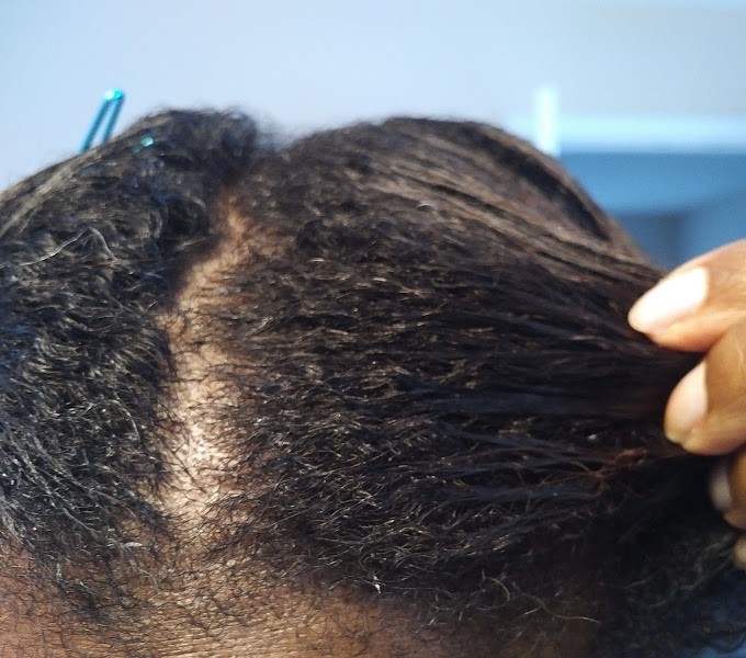 From Straight To Natural Hair A Black Woman S Journey From