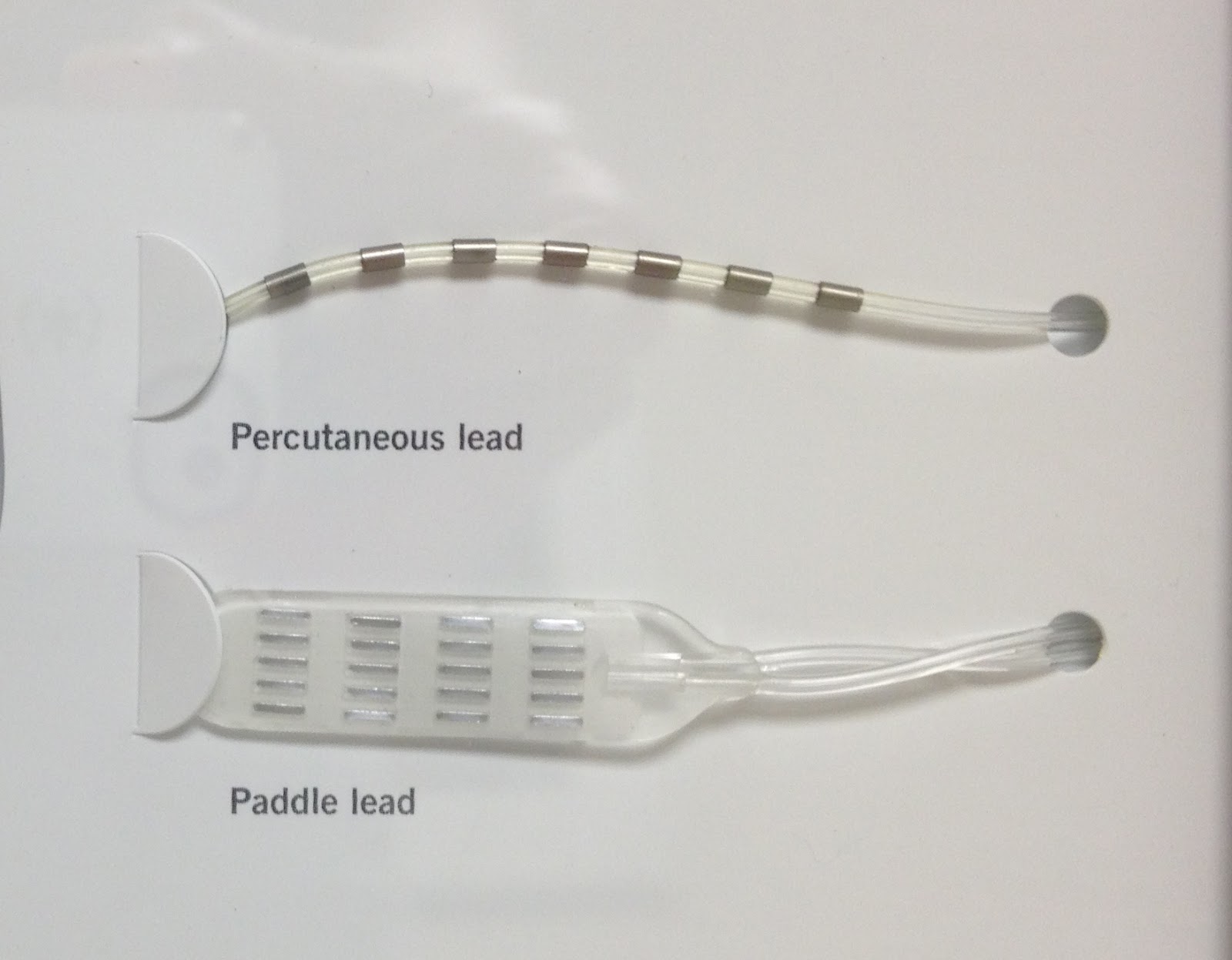 My Spinal Cord Stimulator Journey: Three Week Check