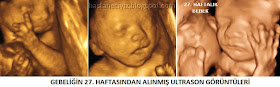 27. hafta ultrason görüntüleri