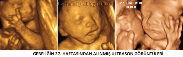 27. hafta ultrason görüntüleri