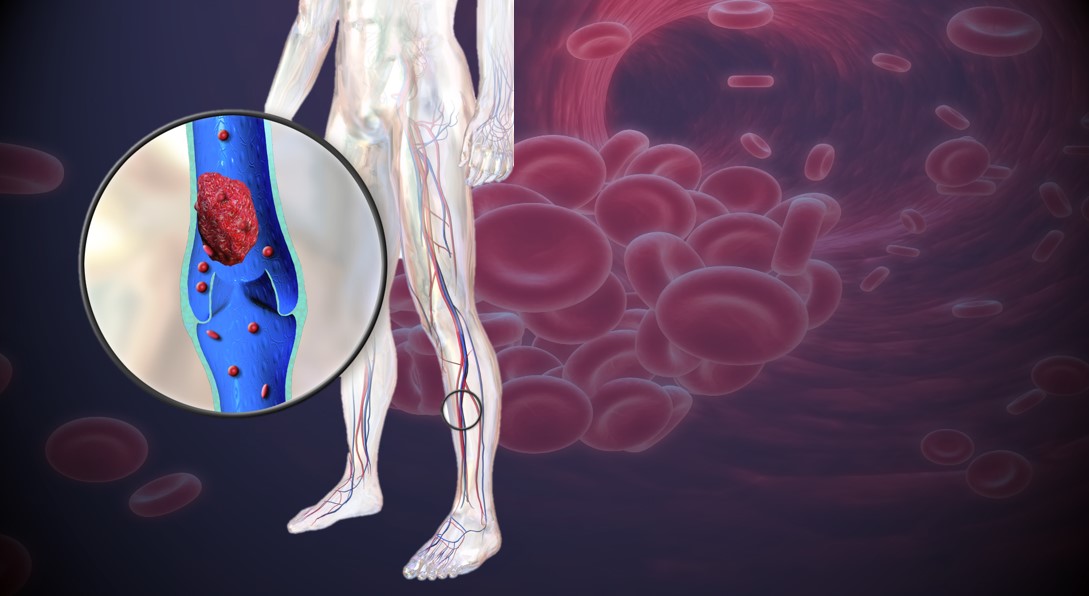 Blood returns to the heart by the motion of the body. Muscles squeeze