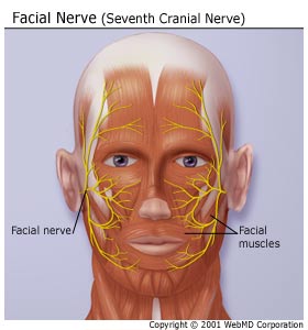 pain Facial from nerve