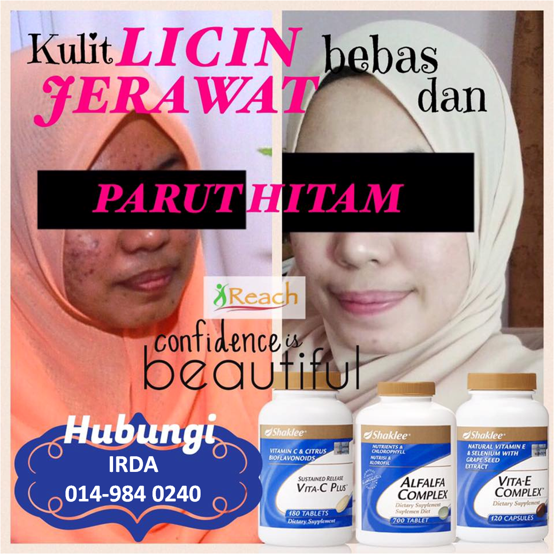 A WAHMpire's Diary PRODUK TERBAIK UNTUK HILANGKAN JERAWAT & CANTIKKAN