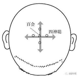 四神聰穴位 | 四神聰穴痛位置 - 穴道按摩經絡圖解 | Source:悅讀中醫