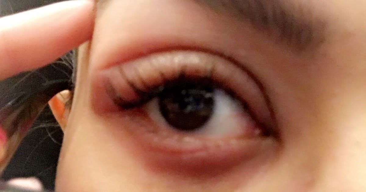 MY DIOR BEAUTY ALLERGIC REACTION!!!! (my experience) SoniaxFyza